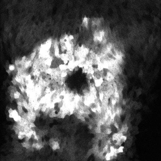 user avatar image for Aaron