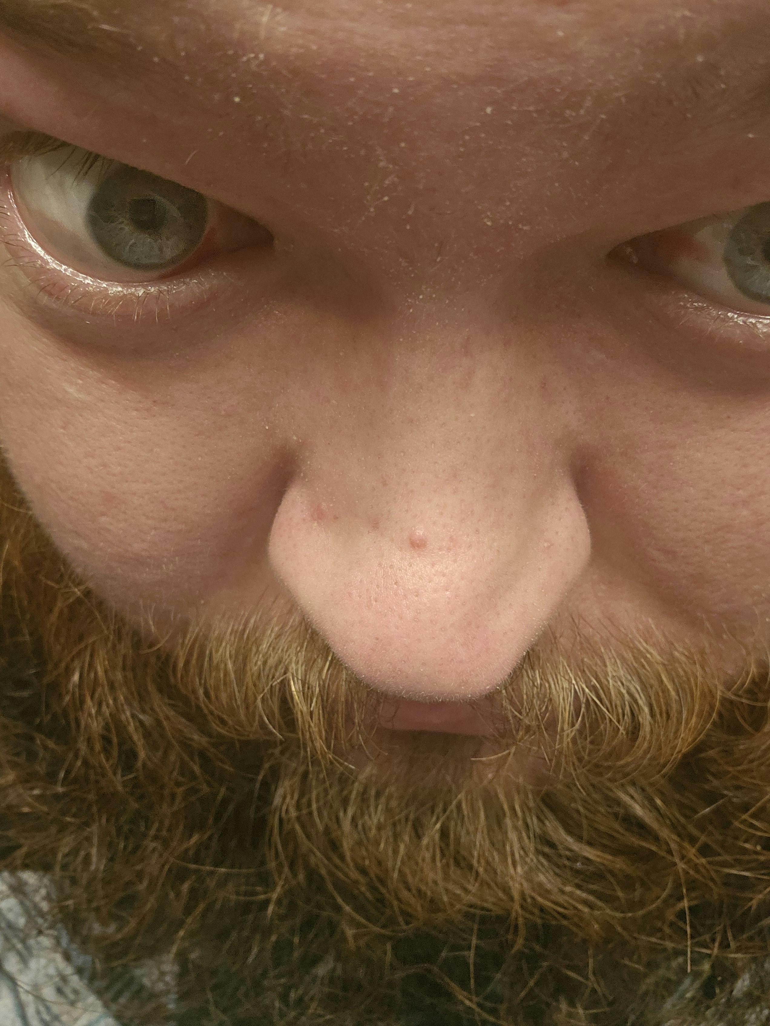 user avatar image for TheMightyBattleSquid