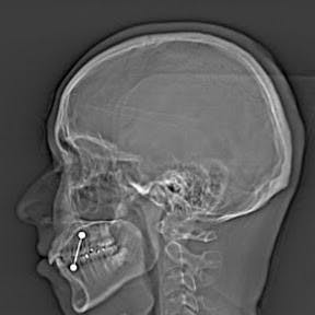 user avatar image for Gabilan