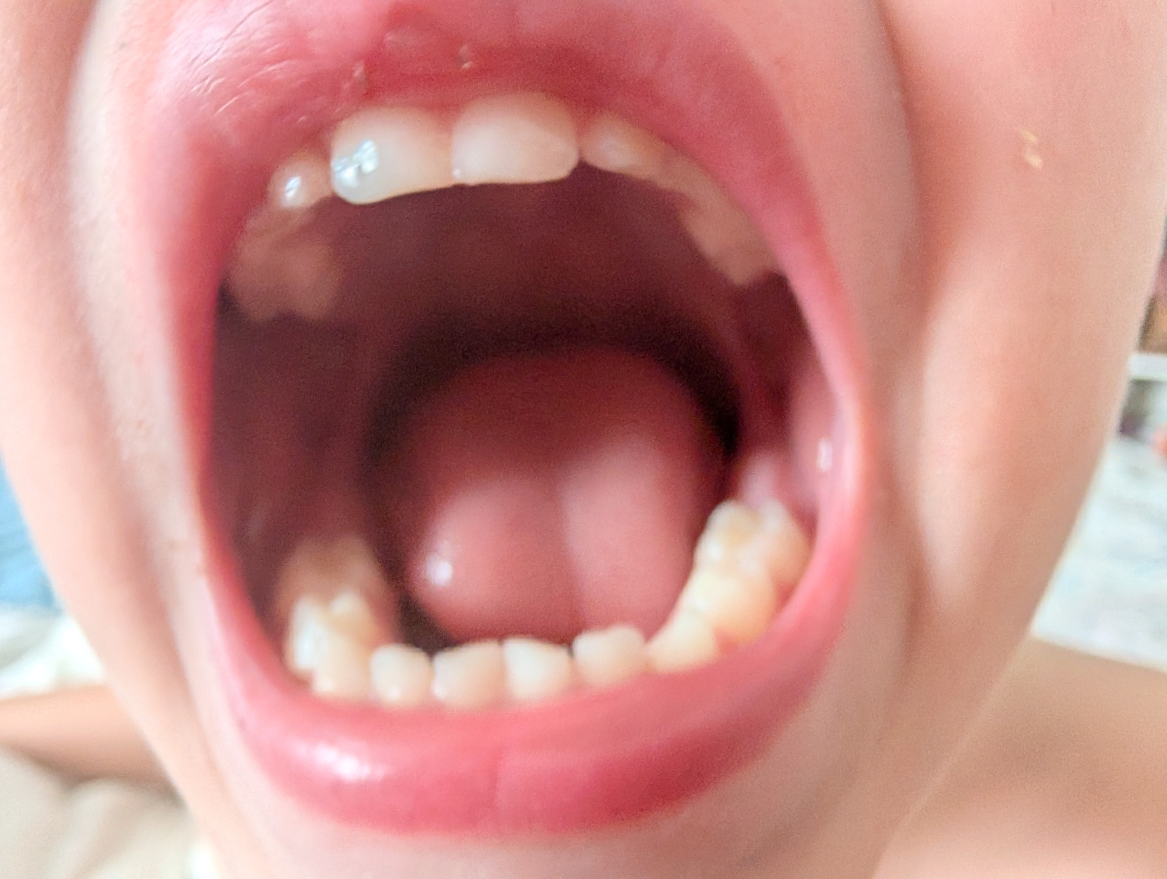 user avatar image for Sporklepop 