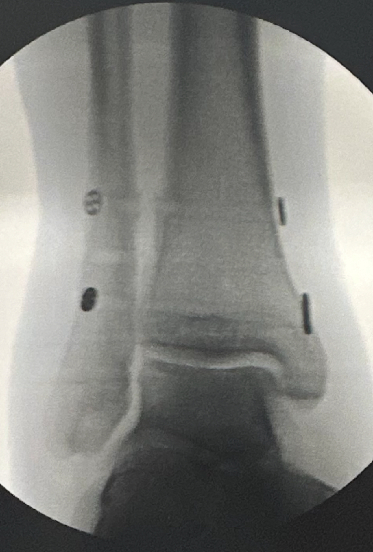 user avatar image for Mike