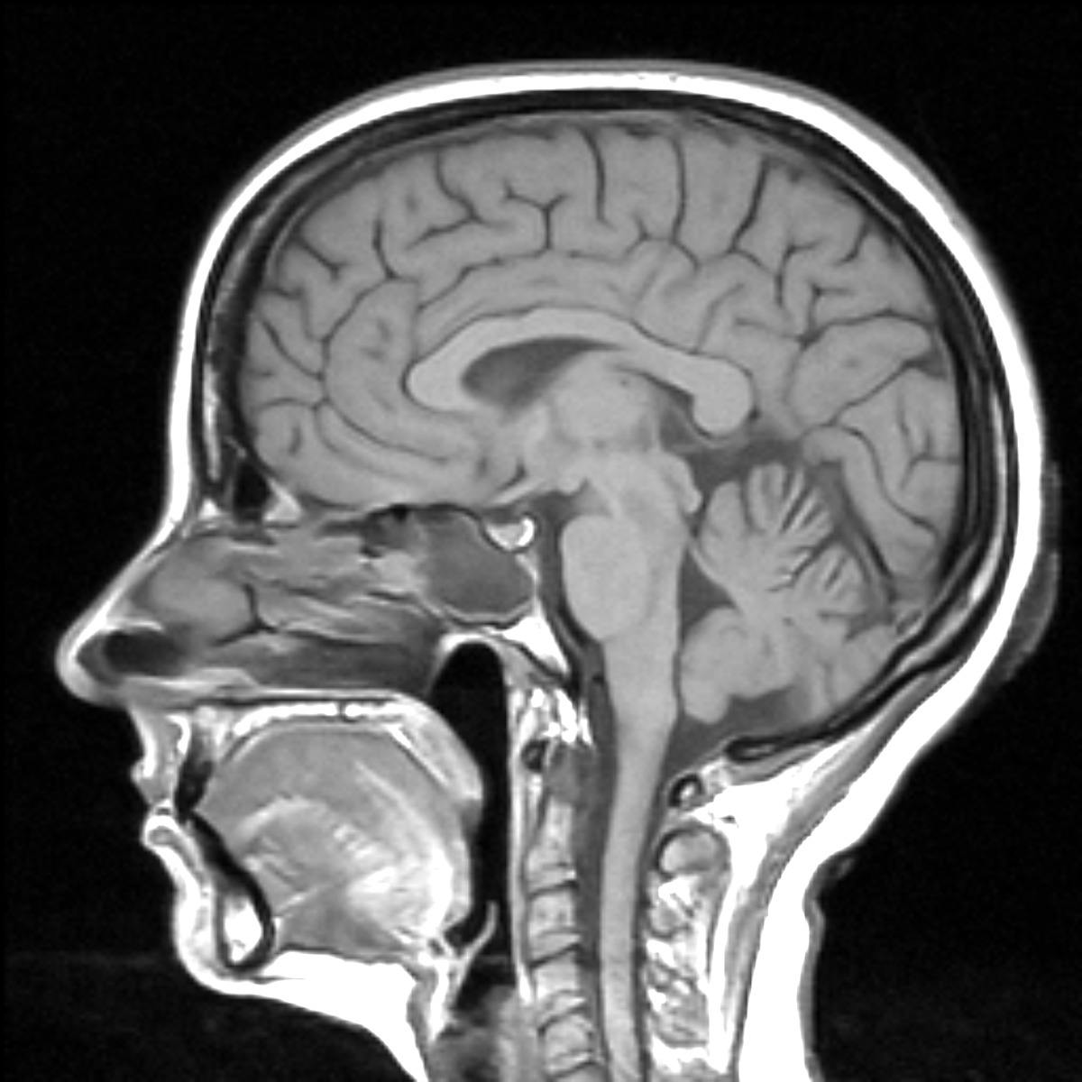 user avatar image for Crystal 