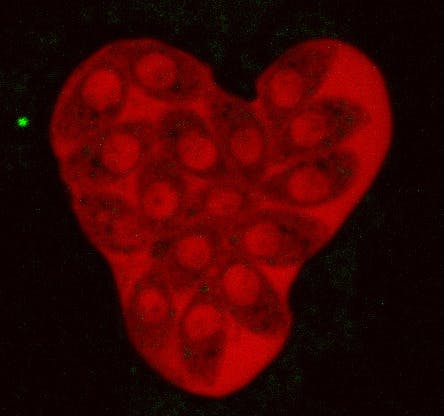 user avatar image for Alen