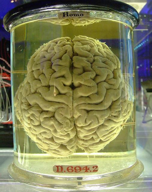user avatar image for lickoutyourbrains